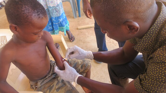 Field team collecting swabs from a yaws lesion for molecular testing. Credit: WHO.