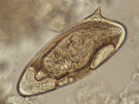 Schistosoma mansoni egg. The miracidium is visible within. Credit Aidan Emery.